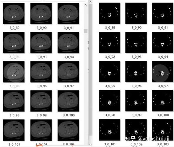 Python spawn enoent-图3